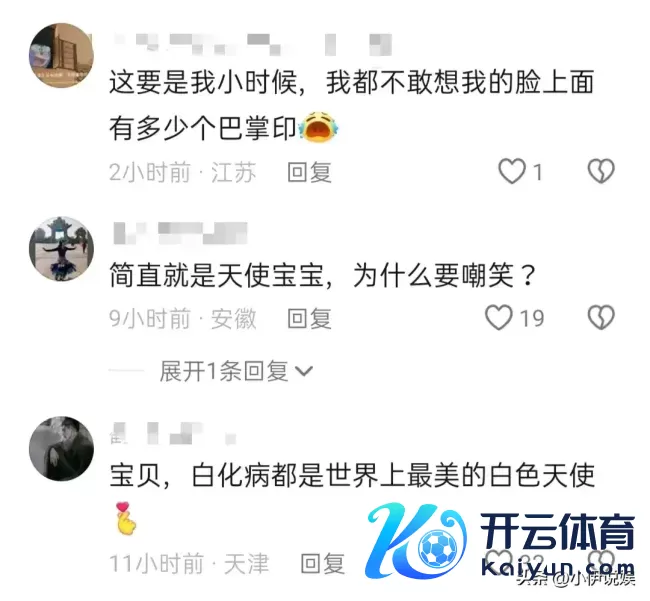 白化病女孩被生分男孩追着说好丑 为何遭到如斯坏心？