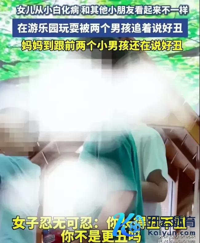 白化病女孩被生分男孩追着说好丑 为何遭到如斯坏心？